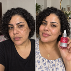 Anua 10+ Serum