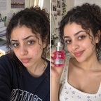 Anua 10+ Serum