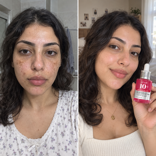 Anua 10+ Serum
