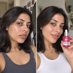 Anua 10+ Serum