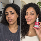 Anua 10+ Serum