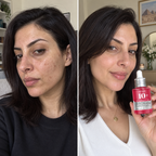 Anua 10+ Serum