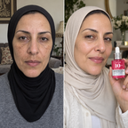 Anua 10+ Serum
