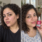 Anua 10+ Serum