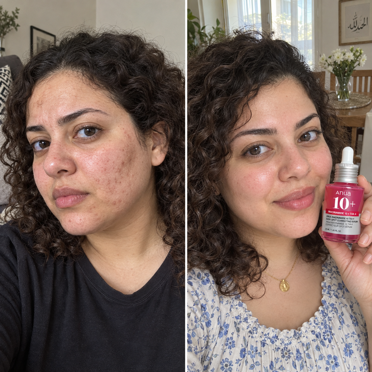 Anua 10+ Serum