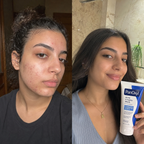 PanOxyl 4% Creamy Wash