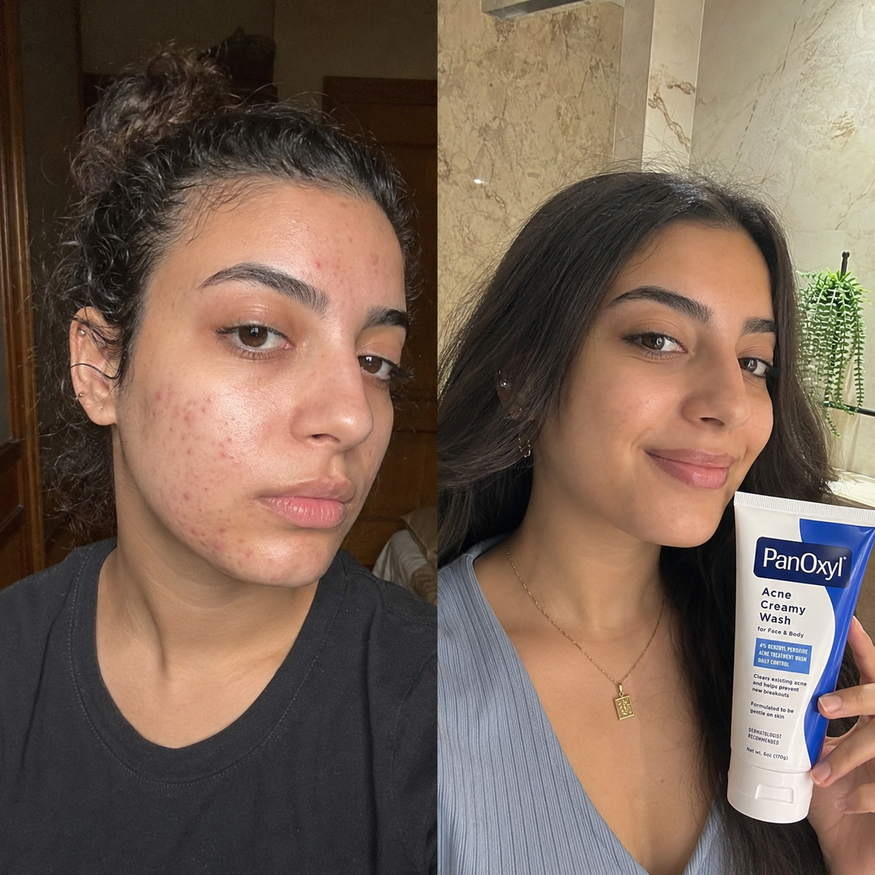 PanOxyl 4% Creamy Wash